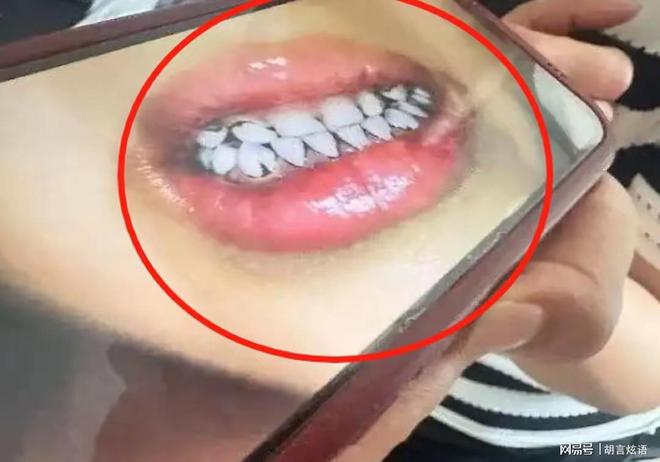 应该不是故意投毒而是不知添加剂内含铅j9九游会入口甘肃天水幼儿园铅中毒(图2)